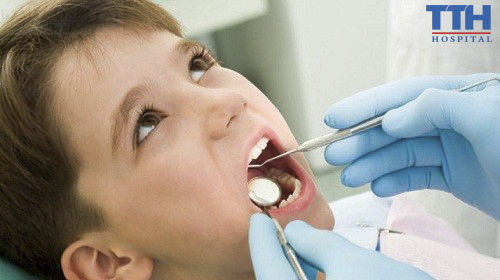 Điều trị tủy răng sữa